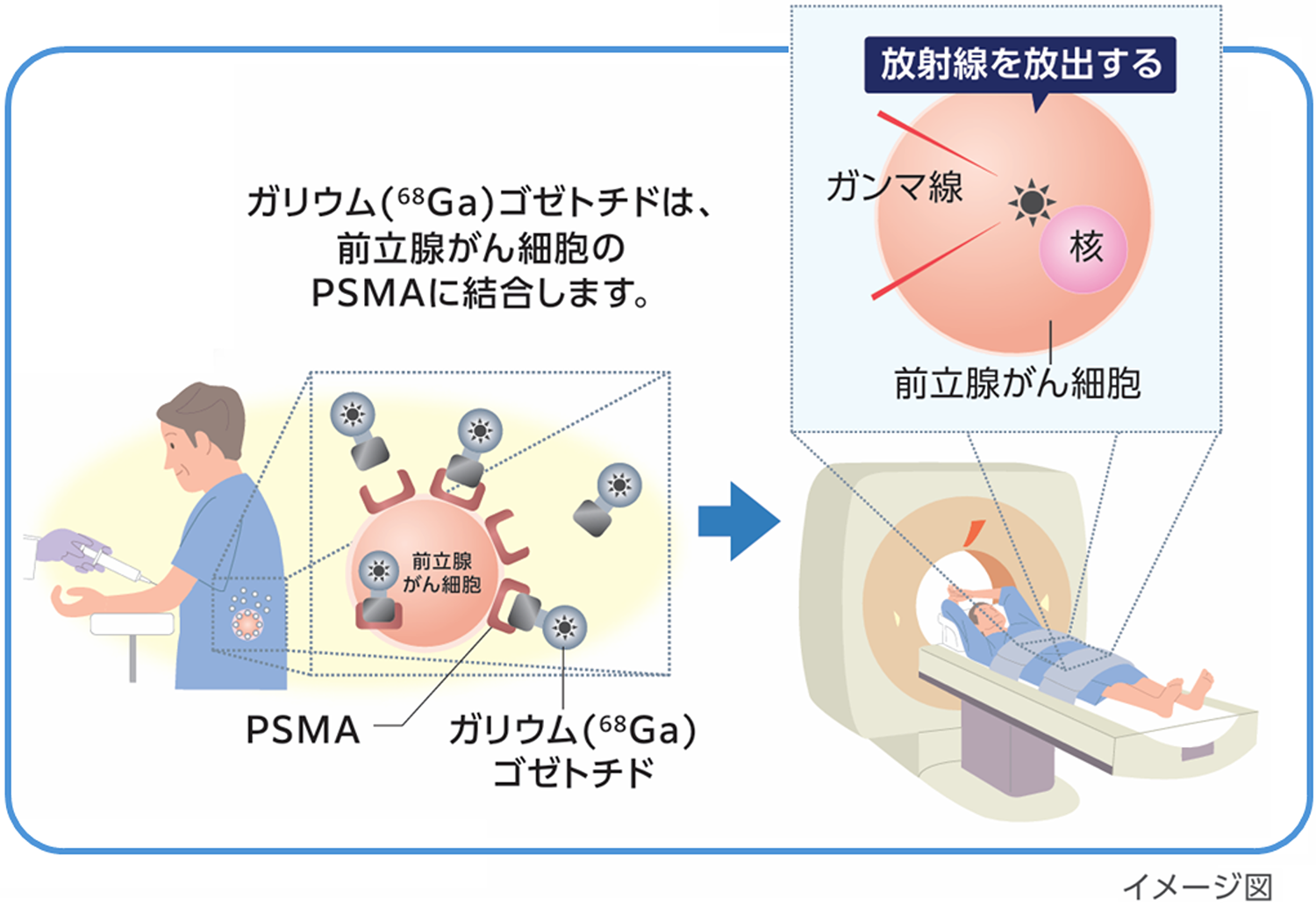 PSMA-PET検査とは?